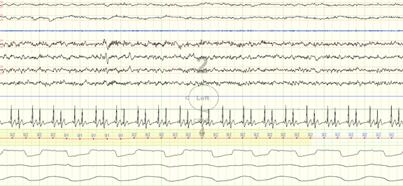 Click here for a larger view. Click here for a larger view.