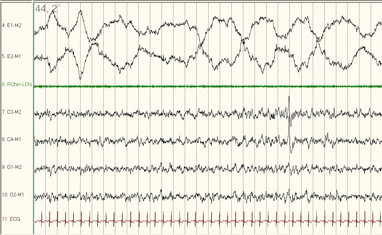 Click here for a larger view. Click here for a larger view.