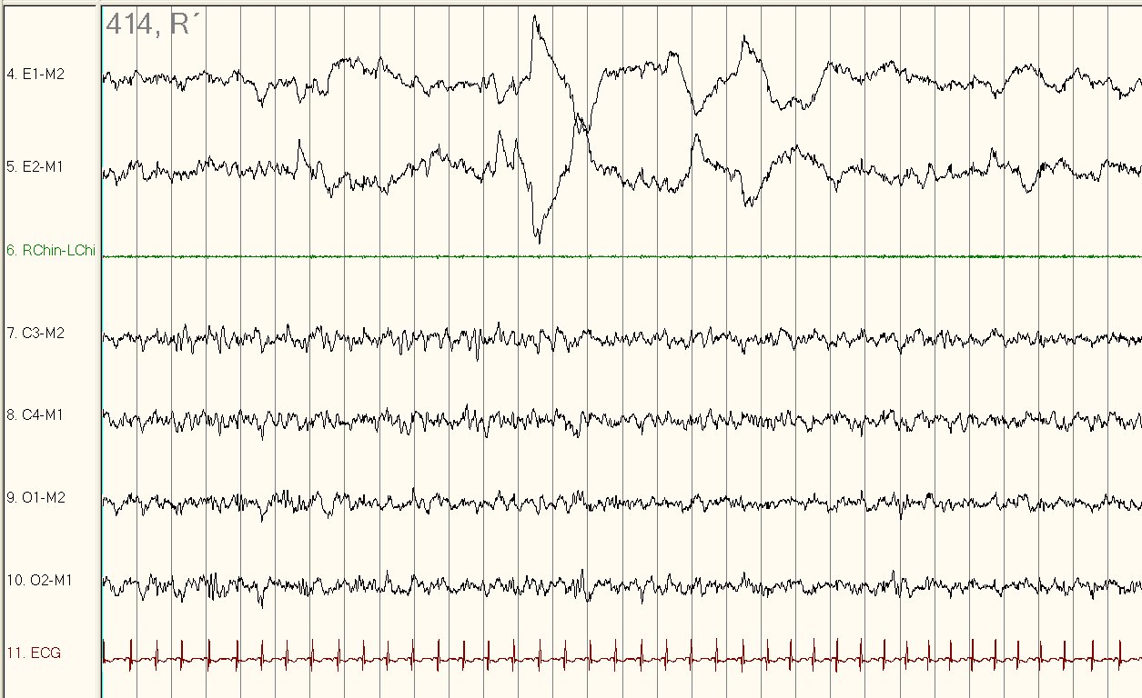 Click here for a larger view. Click here for a larger view.